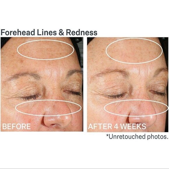 $15🌟 StriVectin Anti-Wrinkle SD Advanced Plus Intensive Moisturizing Cream - Picture 3 of 12